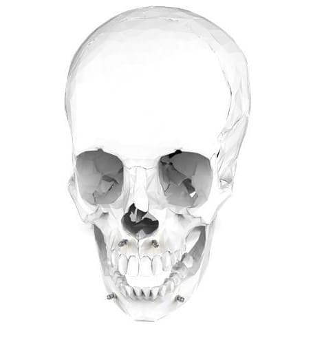 CMX Precision - Imagen 2