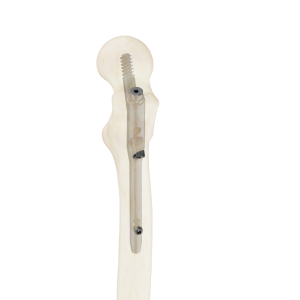 Clavo 10mm Support Fémur Proximal
